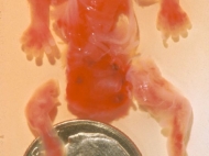 7 Week Abortion (03)