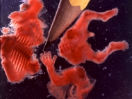 8 Week Abortion (01)