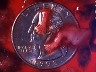 8 Week Abortion (02)