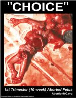 “Choice” Photo #3, 10 Week Body