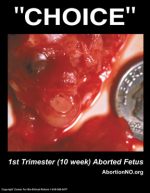  “Choice” Photo #2, 10 Week Face