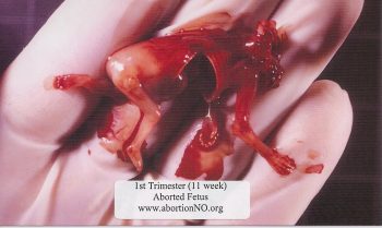 3 X 5 “Choice” Card - 20 pk