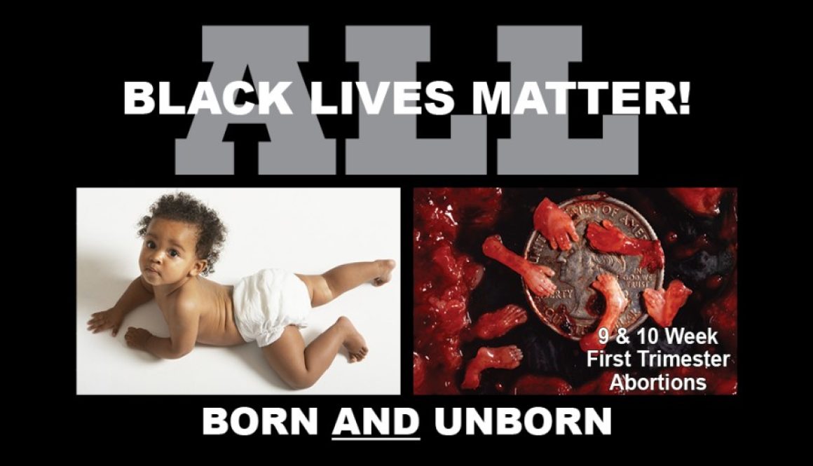 LowRes Black Focus - All Lives Matter