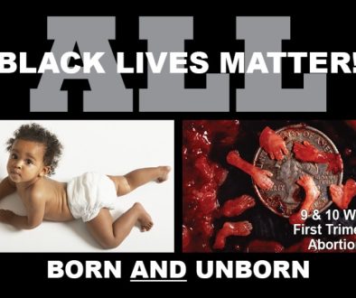 LowRes Black Focus - All Lives Matter