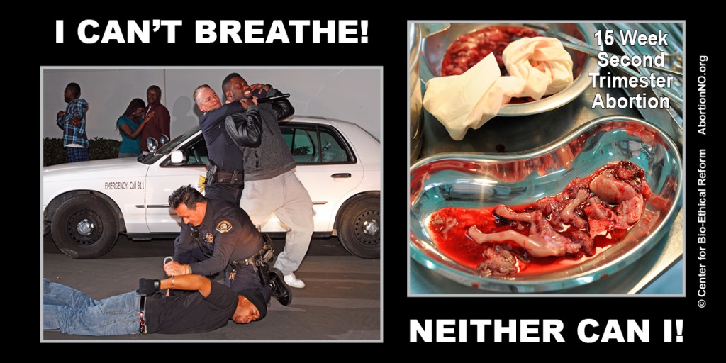 LowRes Black Focus - Can't Breathe