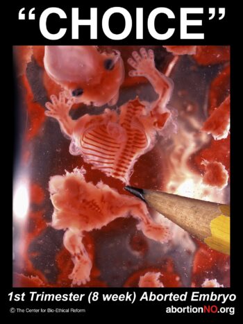 Aborted 08 week baby - pencil