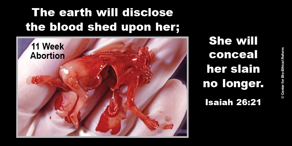 The Earth Will Disclose